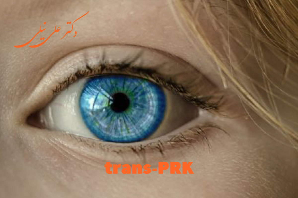 trans prk (ترنس PRK)