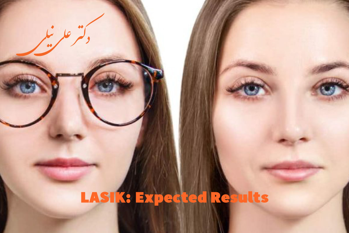 نتایج و عوارض قابل انتظار عمل لیزیک چشم