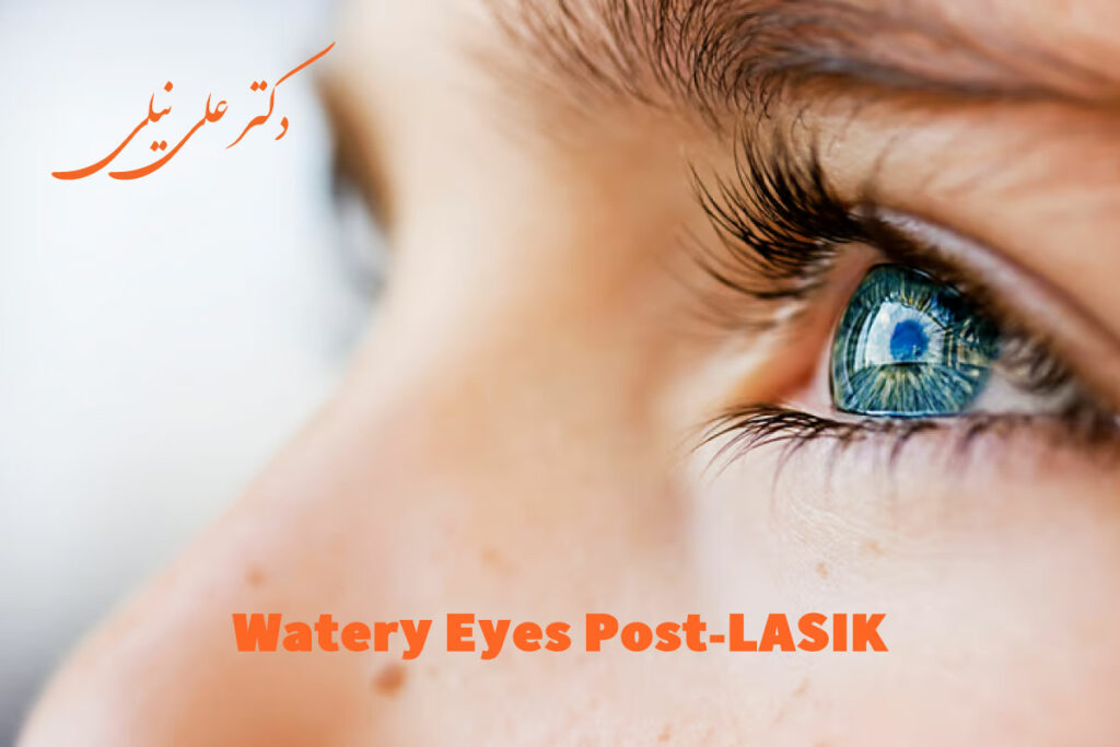 علت آبریزش چشم بعد از عمل لیزیک