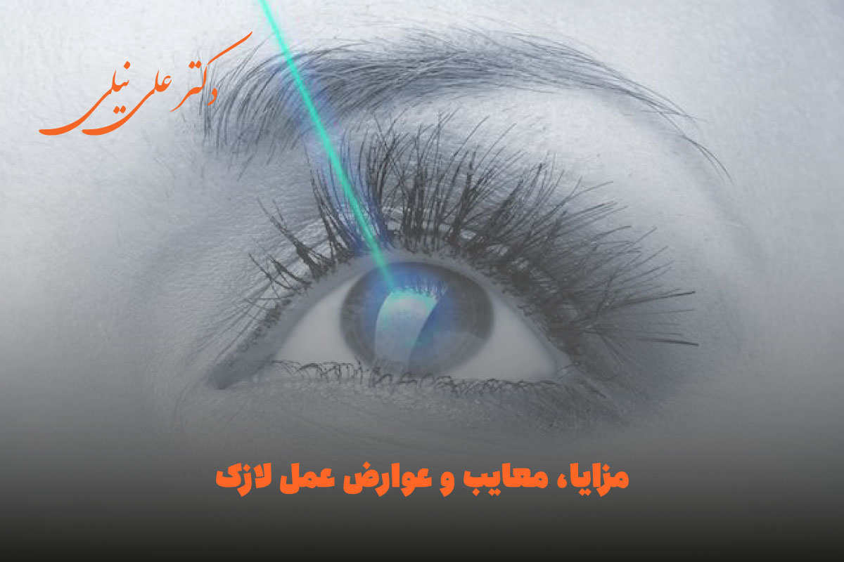 مزایا، معایب و عوارض عمل لازک