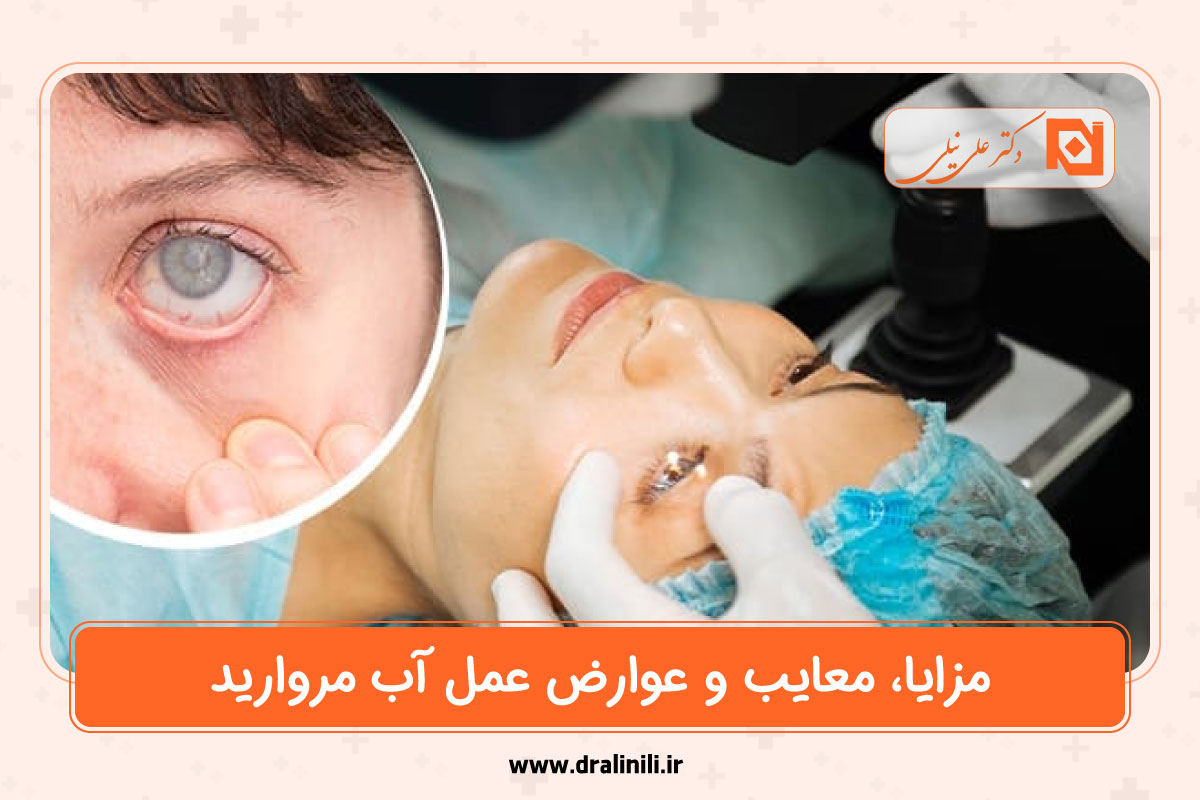 مزایا، معایب و عوارض عمل آب مروارید