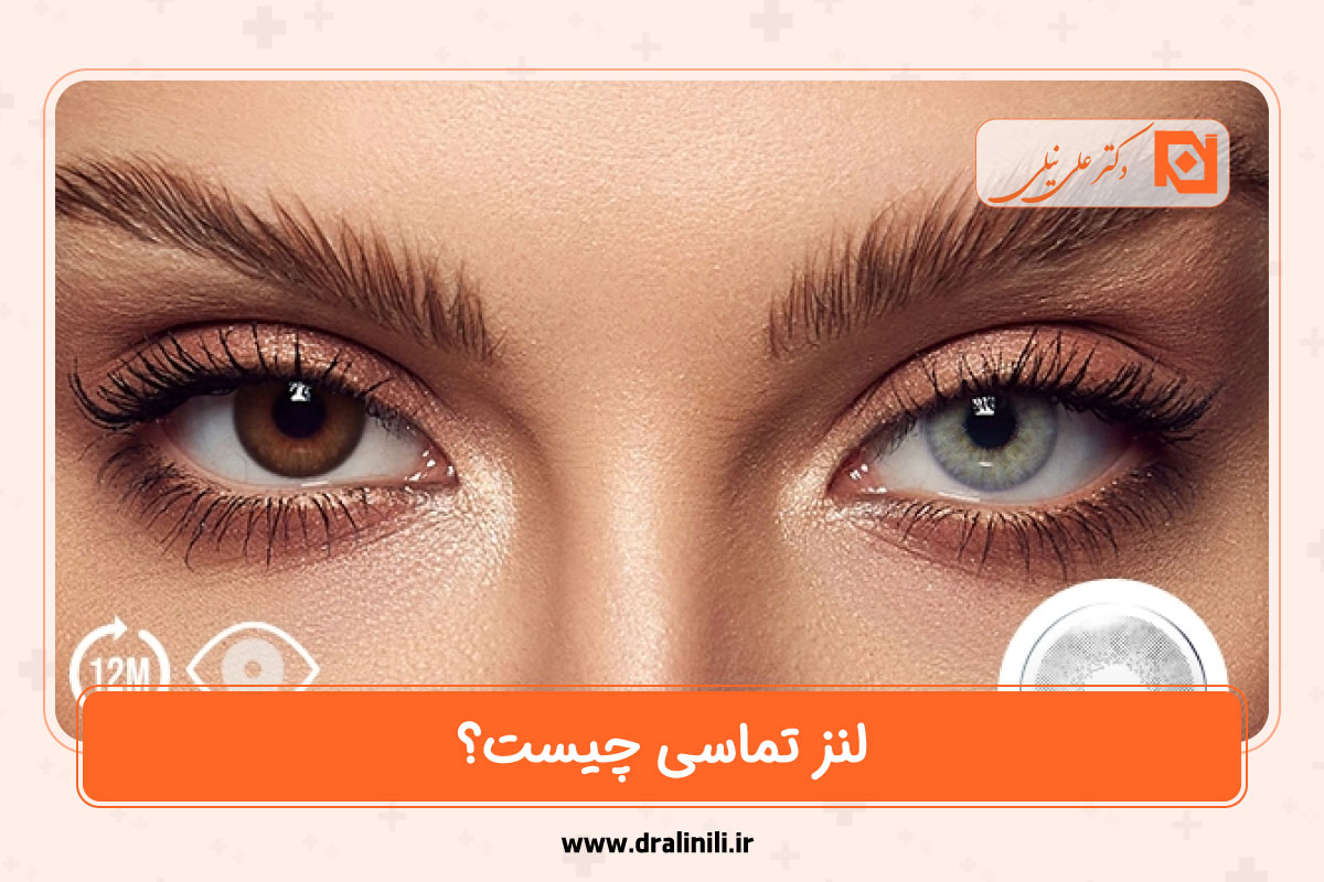 لنز تماسی چیست