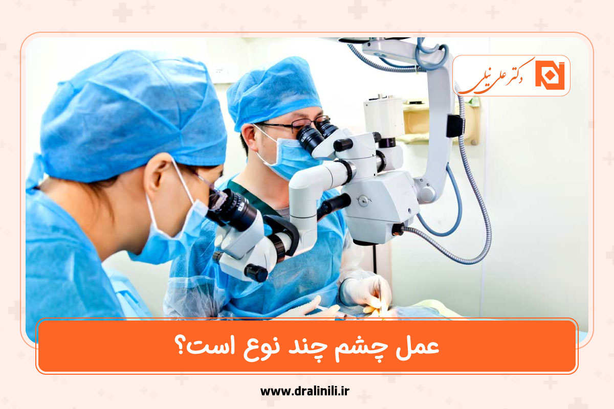 عمل چشم چند نوع است