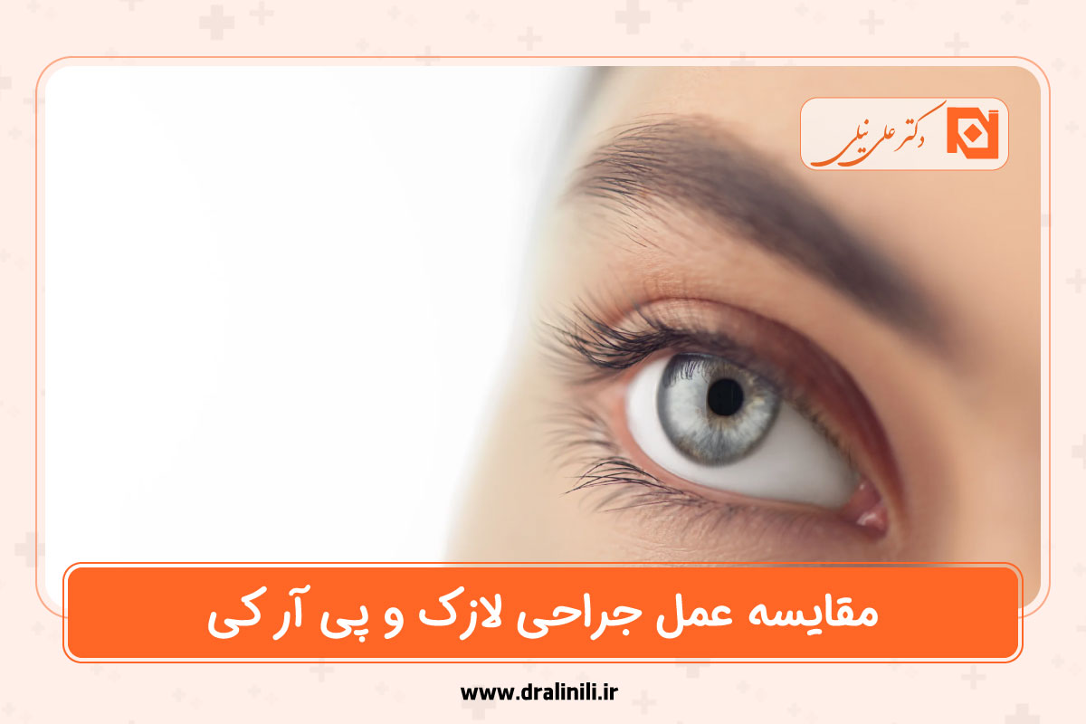 مقایسه عمل لازک چشم و prk