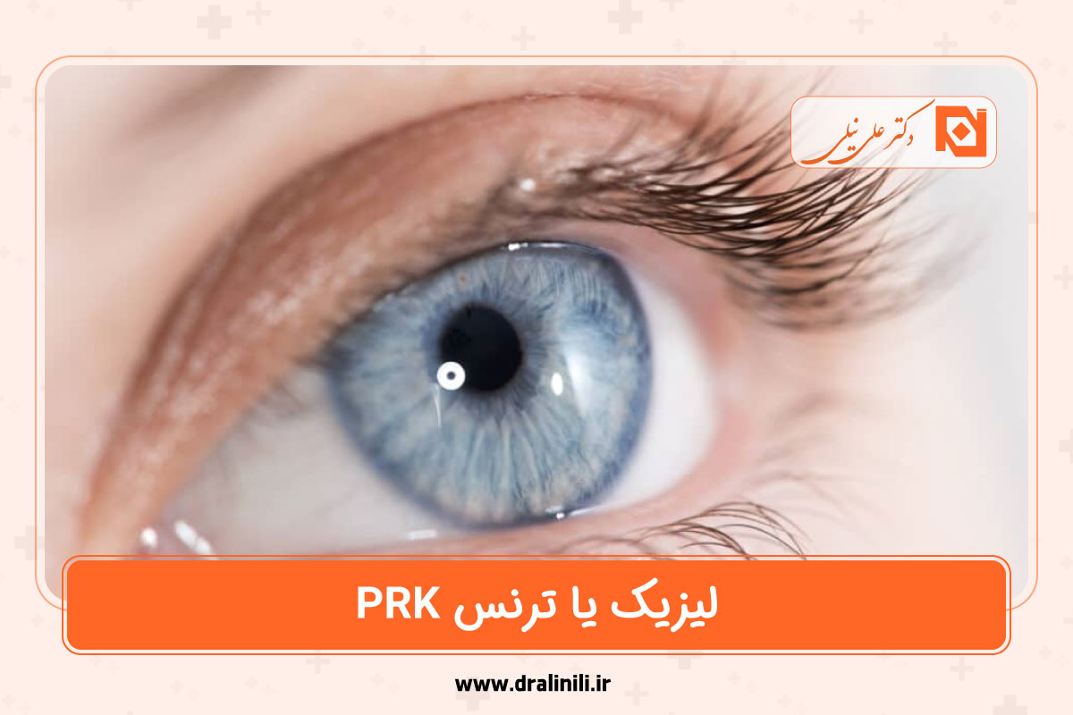 لیزیک یا TransPRK