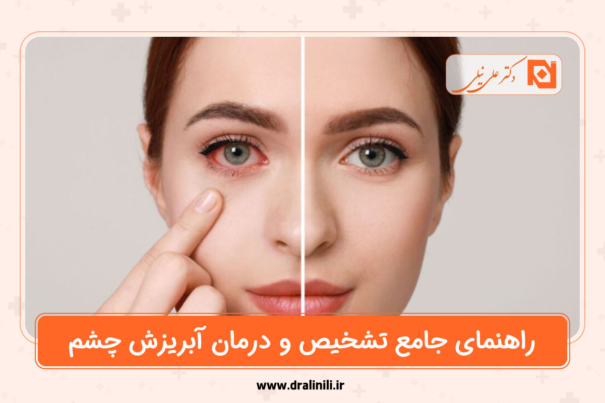 راهنمای جامع تشخیص و درمان آبریزش چشم