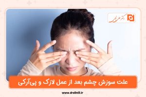 علت سوزش چشم بعد از عمل لازک